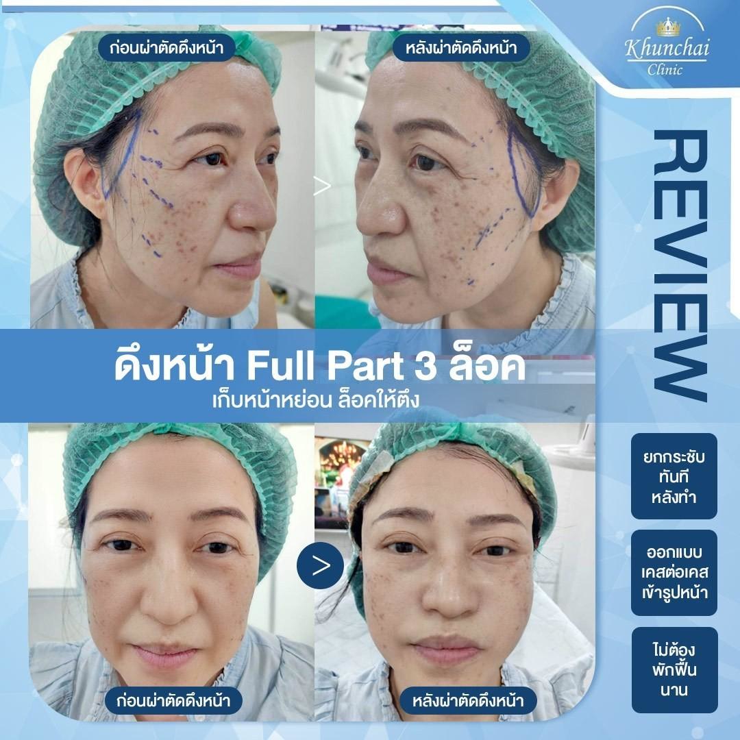 LINE_ALBUM_ดึงหน้า_250917_5