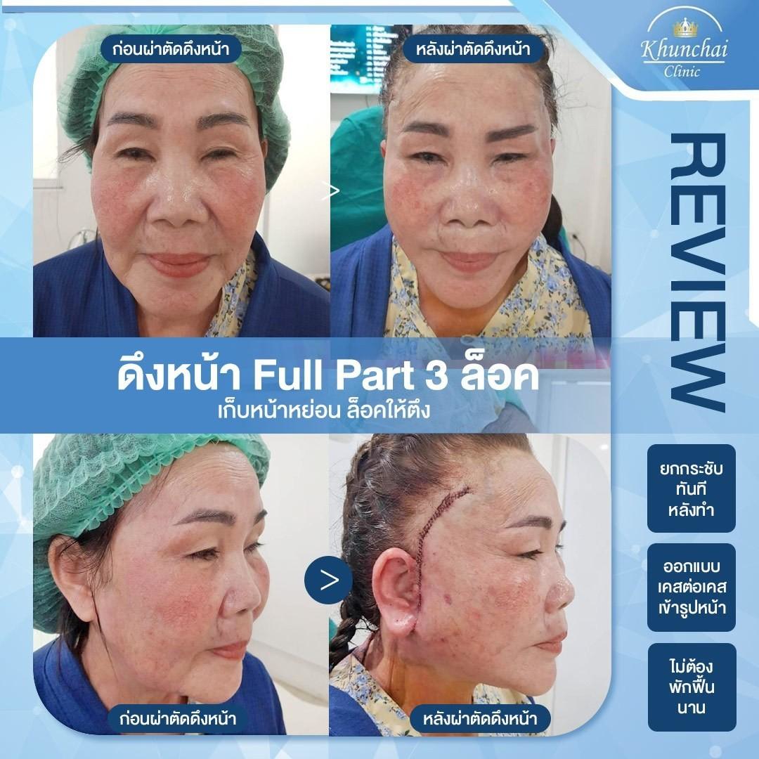 LINE_ALBUM_ดึงหน้า_250917_7