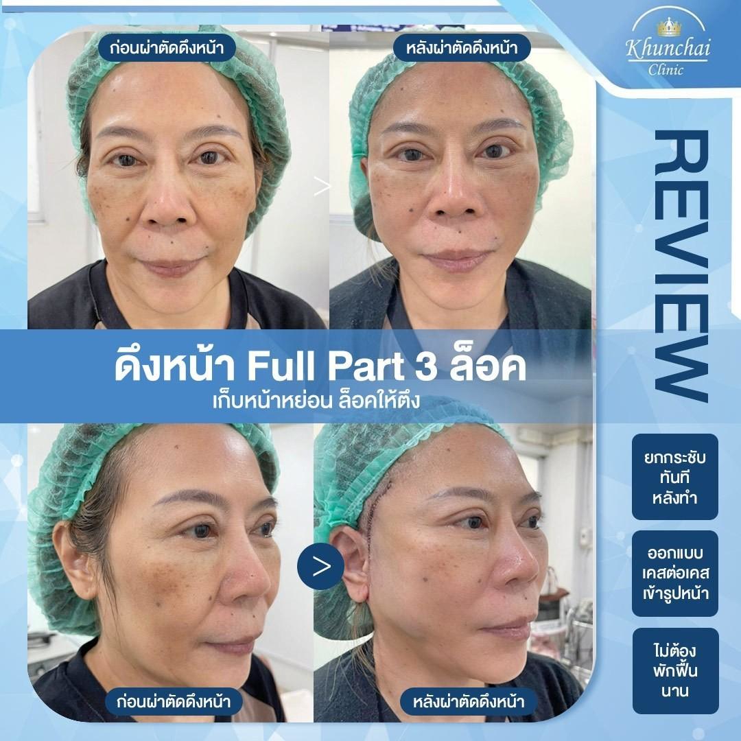 LINE_ALBUM_ดึงหน้า_250917_8