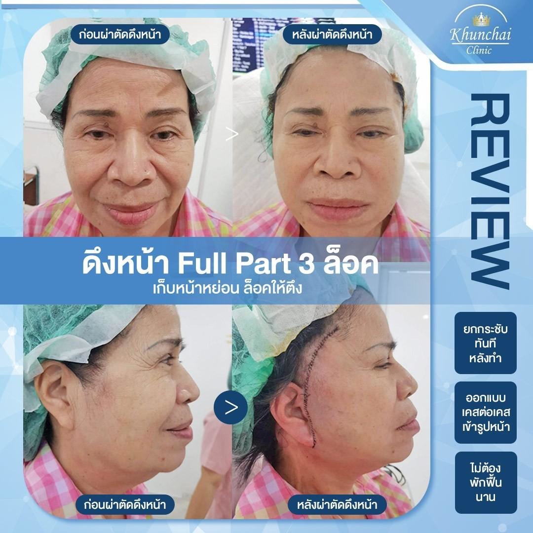 LINE_ALBUM_ดึงหน้า_250917_9