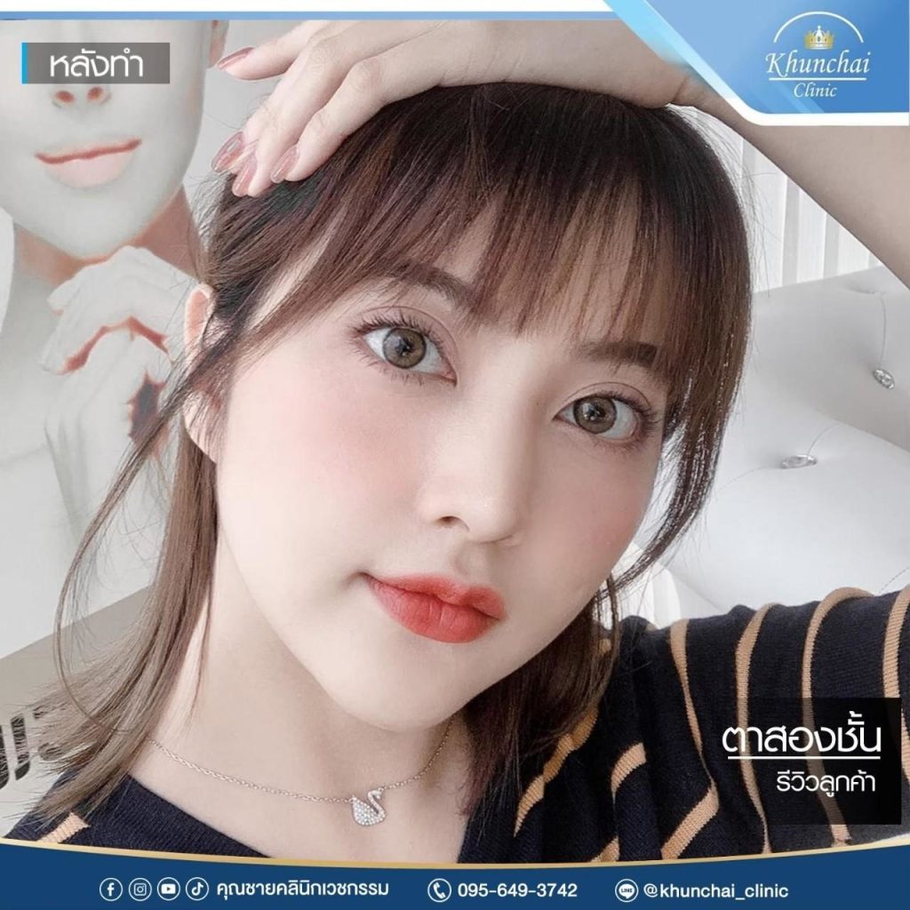 ตาสองชั้น