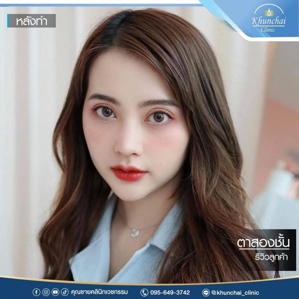 ตาสองชั้น