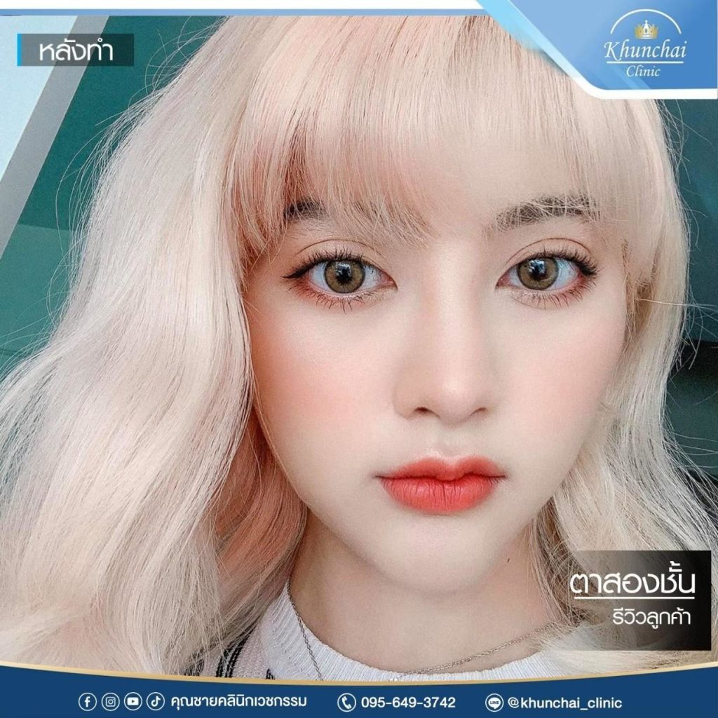 ตาสองชั้น