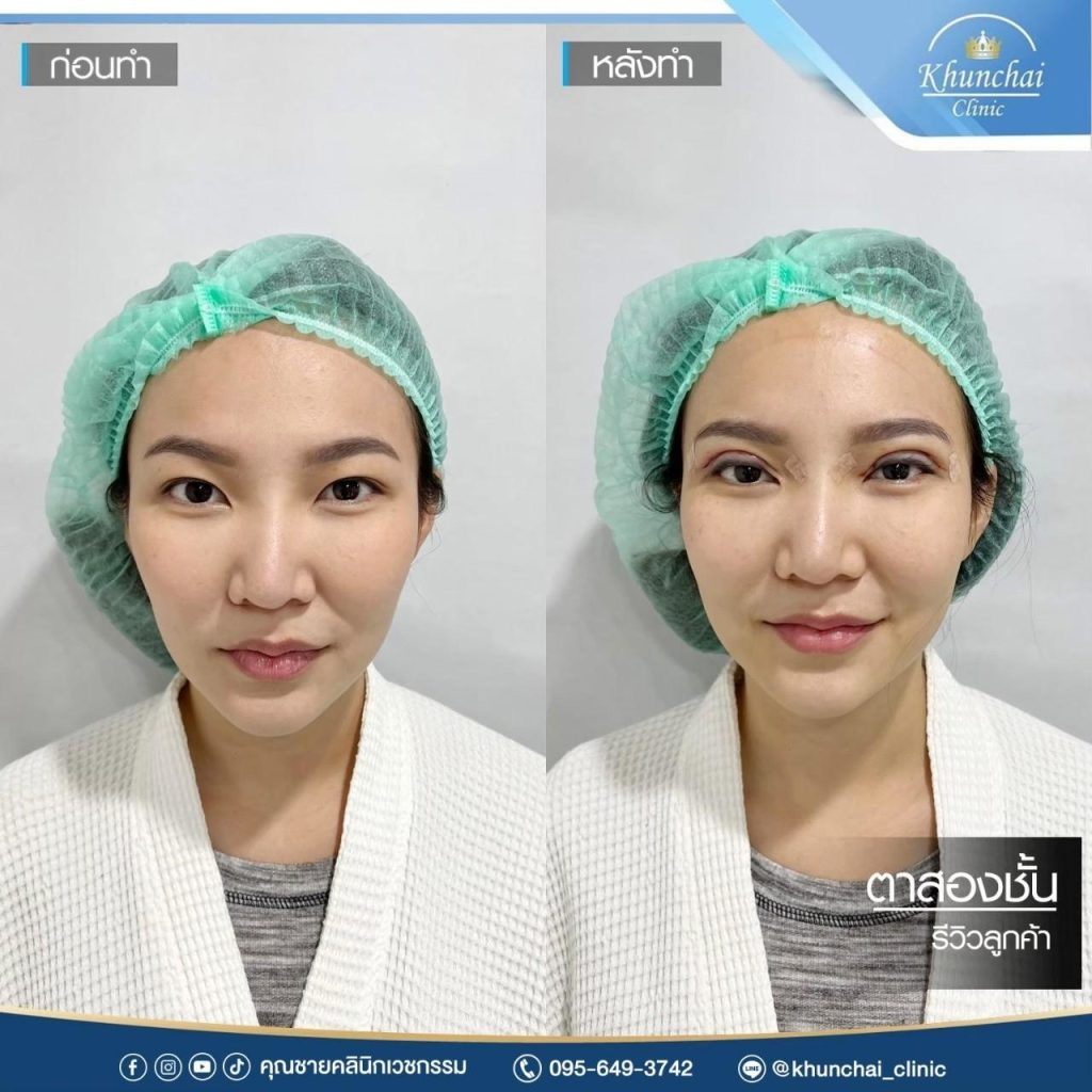 ตาสองชั้น