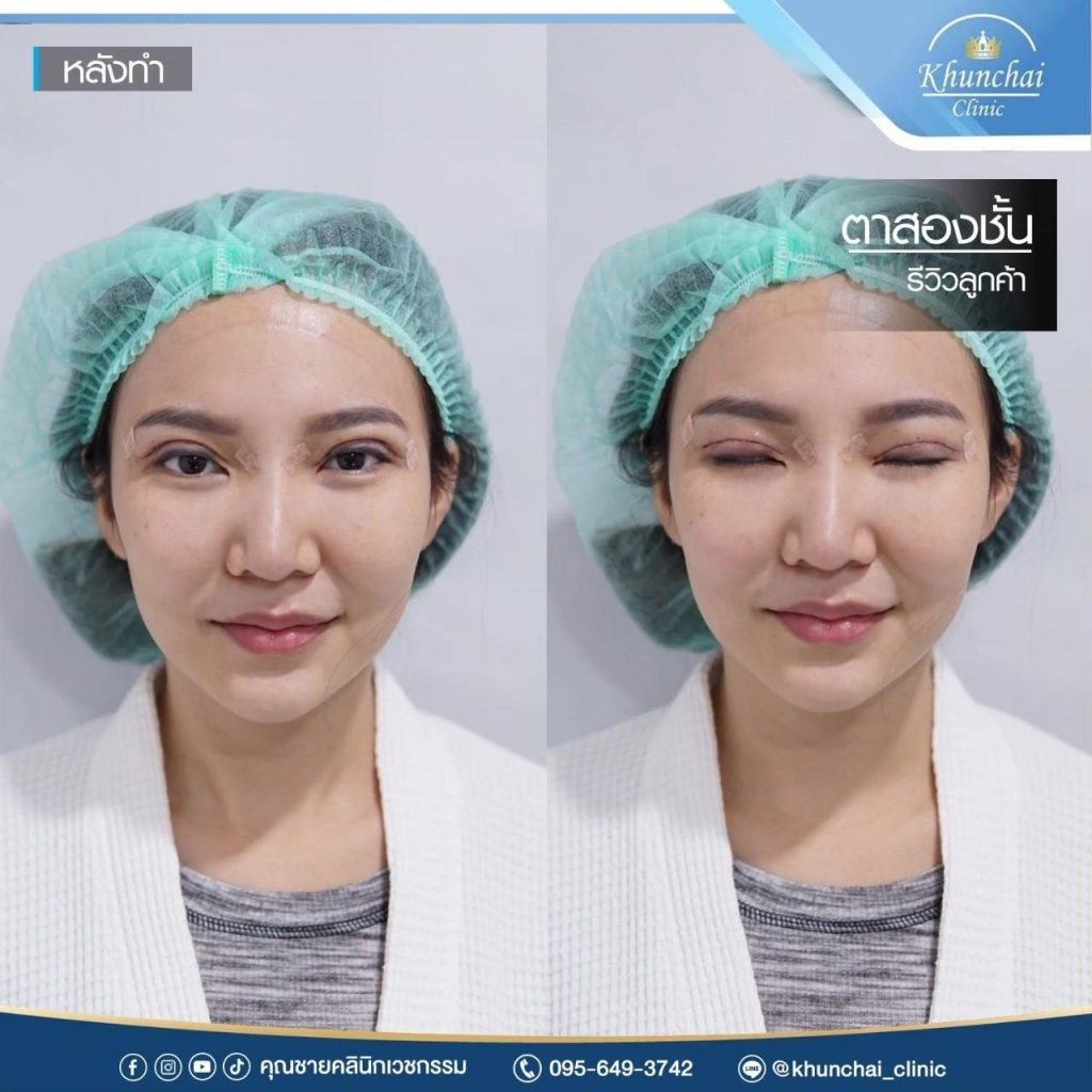 ตาสองชั้น