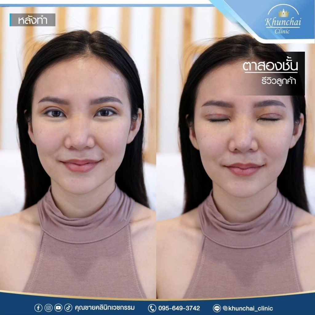 ตาสองชั้น