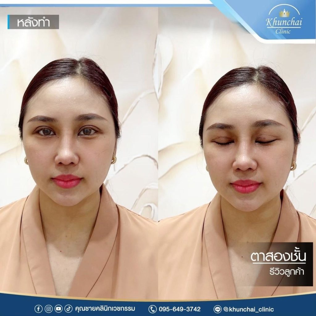 ตาสองชั้น