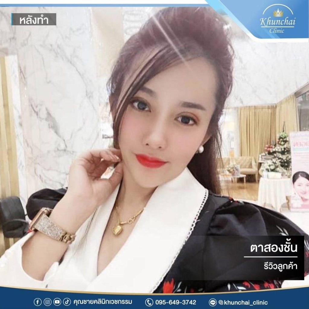 ตาสองชั้น