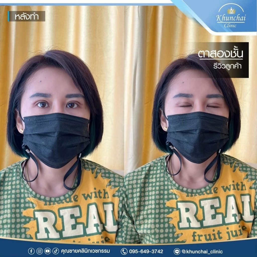 ตาสองชั้น