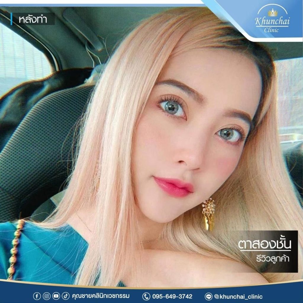 ตาสองชั้น