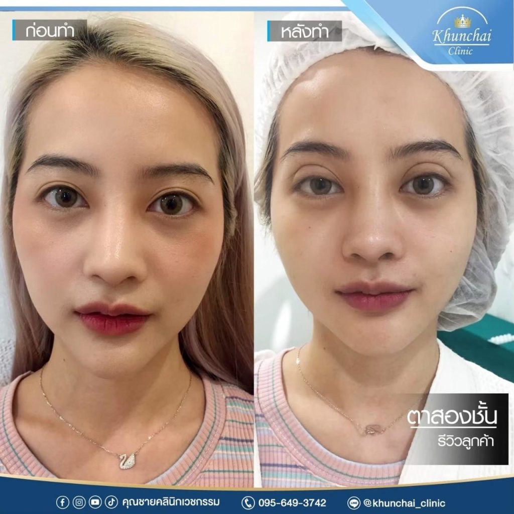 ตาสองชั้น