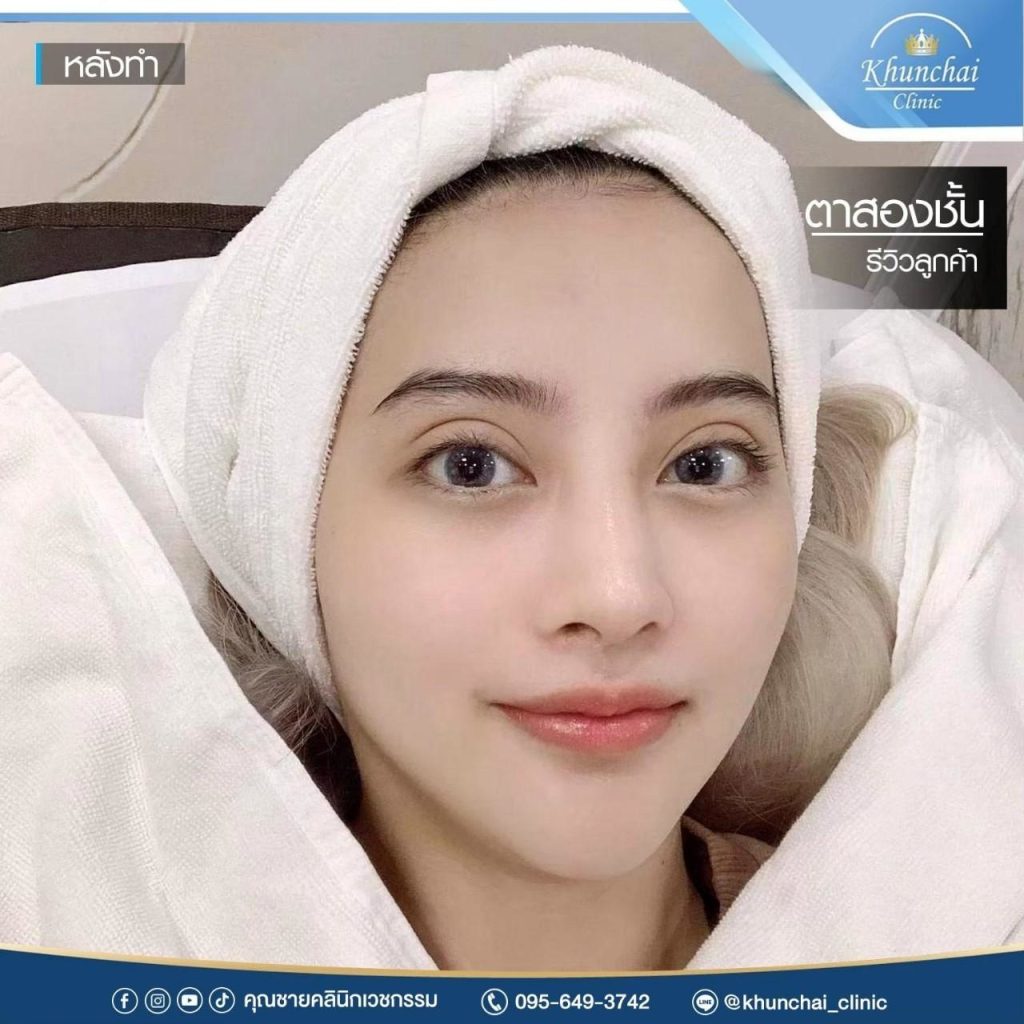 ตาสองชั้น