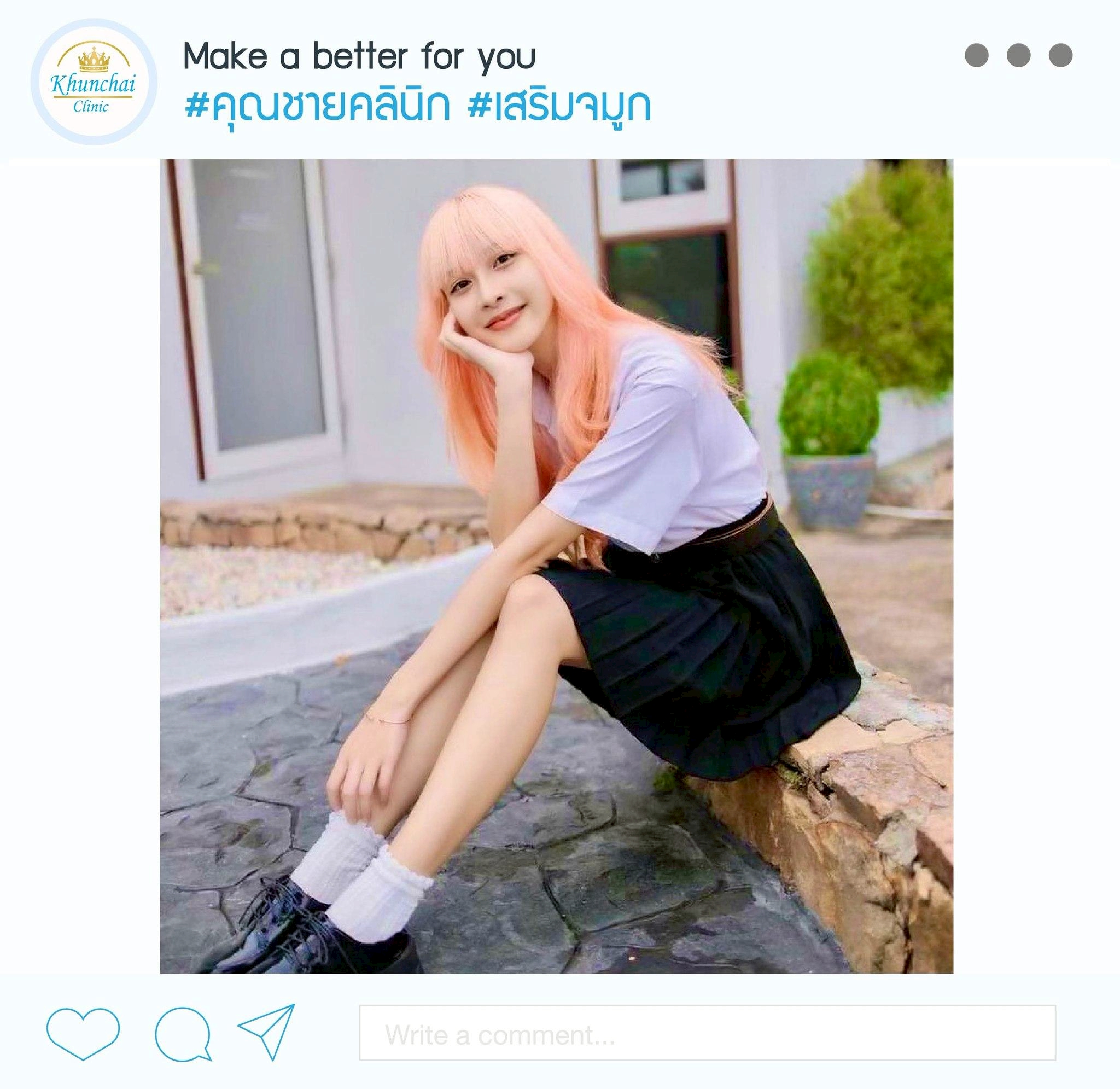 LINE_ALBUM_เสริมจมูก (หญิง)_250917_99